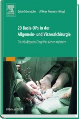 Könyv 20 Basis-OPs in der Allgemein- und Viszeralchirurgie Guido Schumacher