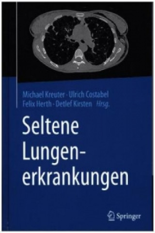 Könyv Seltene Lungenerkrankungen Michael Kreuter