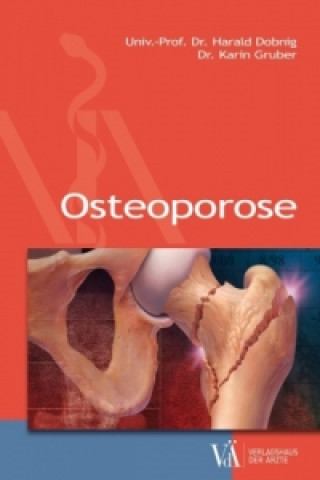 Kniha Osteoporose Harald Dobnig