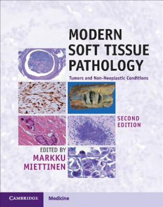 Könyv Modern Soft Tissue Pathology Markku Miettinen