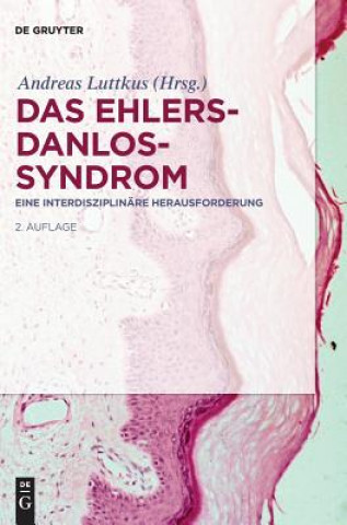 Carte Das Ehlers-Danlos-Syndrom Andreas Luttkus