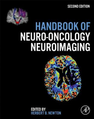 Kniha Handbook of Neuro-Oncology Neuroimaging Herbert B. Newton