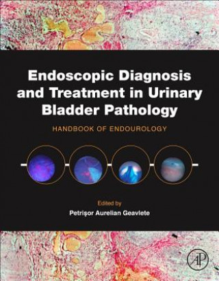 Carte Endoscopic Diagnosis and Treatment in Urinary Bladder Pathology Petrisor Aurelian Geavlete