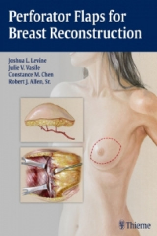 Kniha Perforator Flaps for Breast Reconstruction Joshua L. Levine