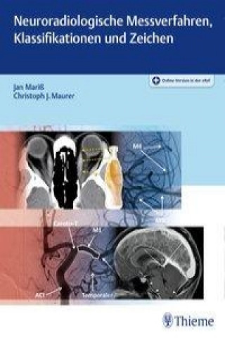 Kniha Neuroradiologische Messverfahren, Klassifikationen und Zeichen Jan Mariß