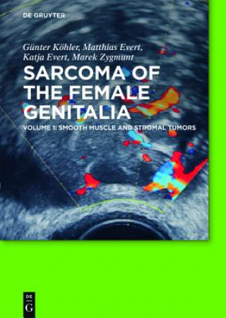 Carte Smooth muscle and stromal tumors and prevention of inadequate surgery. Vol.1 Günter Köhler