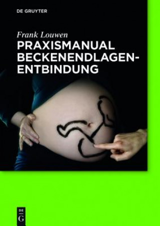 Książka Praxismanual Beckenendlagenentbindung Frank Louwen