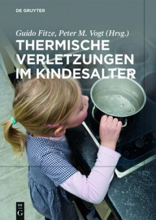 Kniha Thermische Verletzungen im Kindesalter Guido Fitze