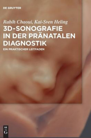 Carte 3D-Sonografie in der pranatalen Diagnostik Rabih Chaoui