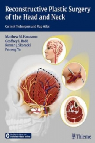 Kniha Reconstructive Plastic Surgery of the Head and Neck Matthew M. Hanasono