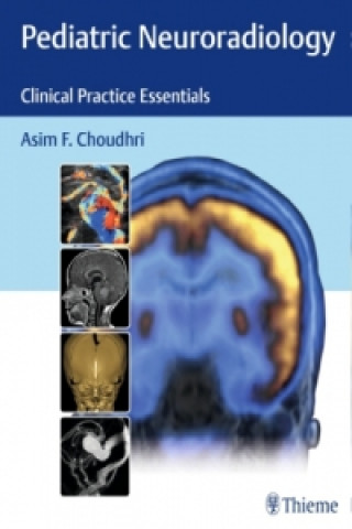 Carte Pediatric Neuroradiology Asim F. Choudhri
