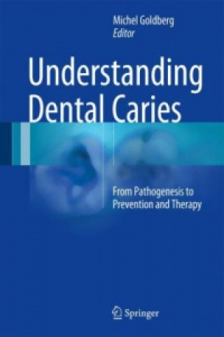 Kniha Understanding Dental Caries Michel Goldberg
