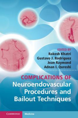 Kniha Complications of Neuroendovascular Procedures and Bailout Techniques Rakesh Khatri