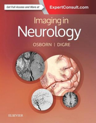 Książka Imaging in Neurology Anne G. Osborn