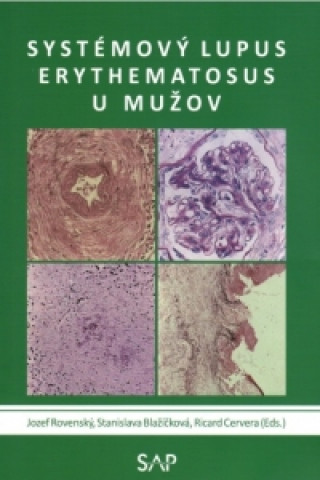 Книга Systémový lupus erythematosus u mužov Jozef Rovenský