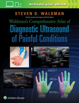 Carte Waldman's Comprehensive Atlas of Diagnostic Ultrasound of Painful Conditions Steven D. Waldman