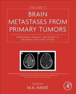 Kniha Brain Metastases from Primary Tumors, Volume 3 M. Hayat