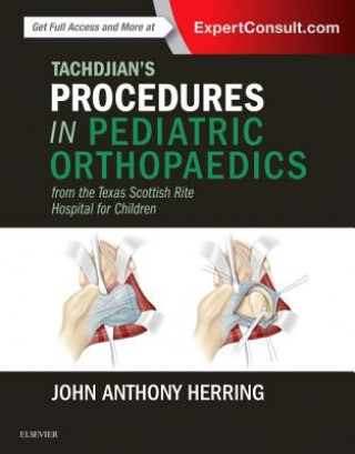 Książka Tachdjian's Procedures in Pediatric Orthopaedics John Herring