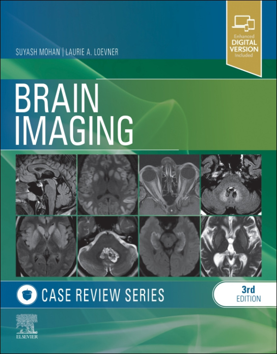 Könyv Brain Imaging Laurie Loevner