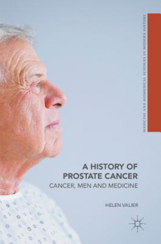 Könyv History of Prostate Cancer Helen Valier