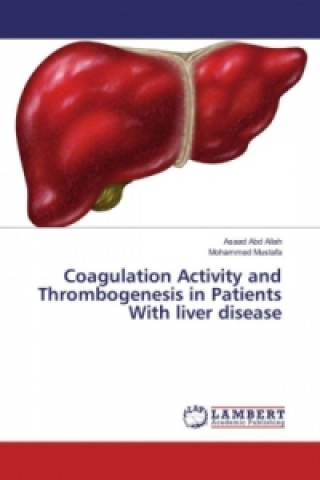 Kniha Coagulation Activity and Thrombogenesis in Patients With liver disease Asaad Abd Allah