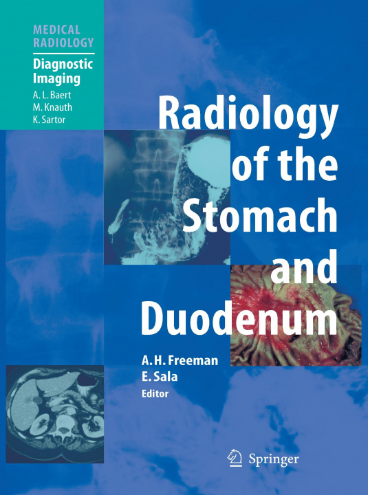 Knjiga Radiology of the Stomach and Duodenum Alan H. Freeman