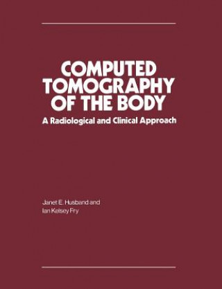 Книга Computed Tomography of the Body Janet E. Husband