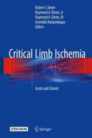 Carte Critical Limb Ischemia Robert Dieter