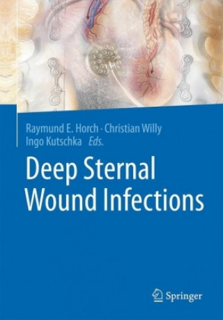 Kniha Deep Sternal Wound Infections Raymund E. Horch