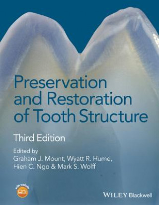Kniha Preservation and Restoration of Tooth Structure 3e Graham J. Mount