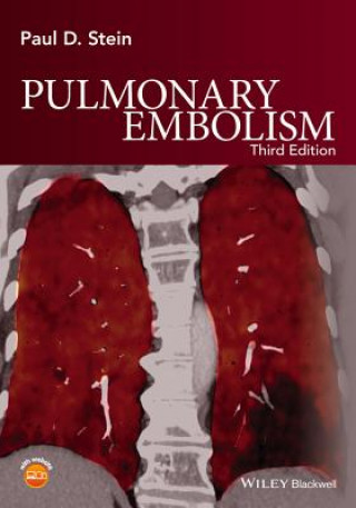 Książka Pulmonary Embolism 3e Paul D. Stein