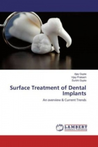 Kniha Surface Treatment of Dental Implants Ajay Gupta