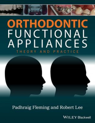 Kniha Orthodontic Functional Appliances - Theory and Practice Padhraig S. Fleming