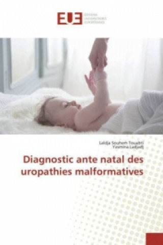 Carte Diagnostic ante natal des uropathies malformatives Laldja Souhem Touabti