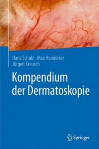 Kniha Kompendium der Dermatoskopie Hans Schulz