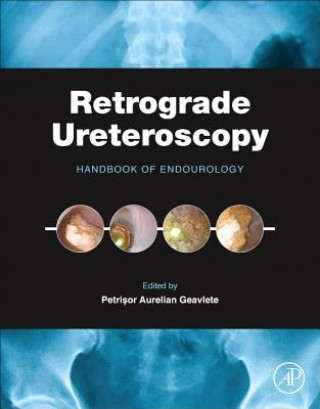 Knjiga Retrograde Ureteroscopy Petrisor Aurelian Geavlete