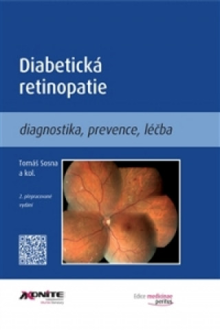 Book Diabetická retinopatie Tomáš Sosna