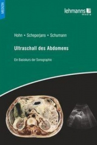 Carte Ultraschallanatomie des Abdomens Hans-Peter Hohn