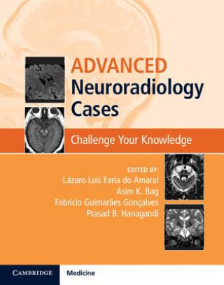 Kniha Advanced Neuroradiology Cases Lázaro Luís Faria do Amaral