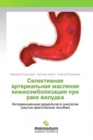 Kniha Selektivnaya arterial'naya maslyanaya himiojembolizaciya pri rake zheludka Vladimir Polysalov