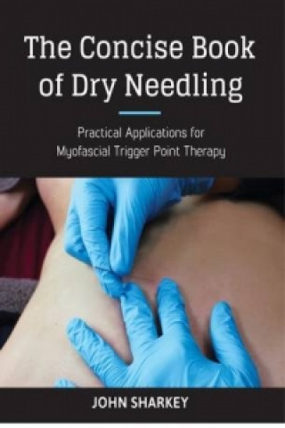 Książka Concise Book of Dry Needling John Sharkey