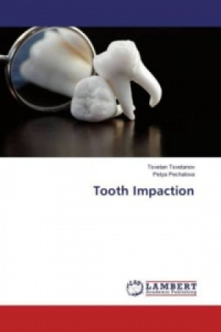 Книга Tooth Impaction Tsvetan Tsvetanov