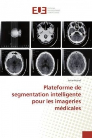 Kniha Plateforme de segmentation intelligente pour les imageries médicales Jarrar Manel