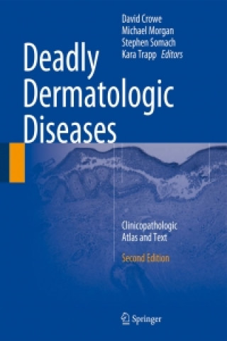 Carte Deadly Dermatologic Diseases David R. Crowe