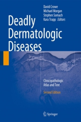 Book Deadly Dermatologic Diseases David R. Crowe