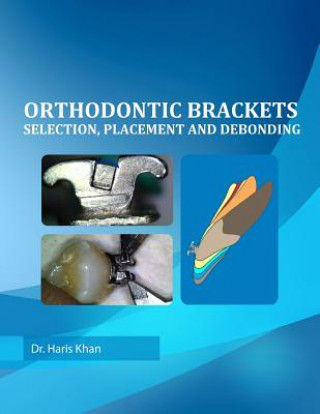 Książka Orthodontic Brackets Dr Haris Khan