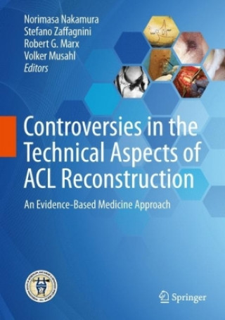 Książka Controversies in the Technical Aspects of ACL Reconstruction Norimasa Nakamura