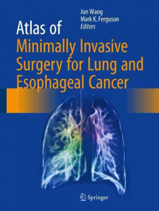 Kniha Atlas of Minimally Invasive Surgery for Lung and Esophageal Cancer Jun Wang