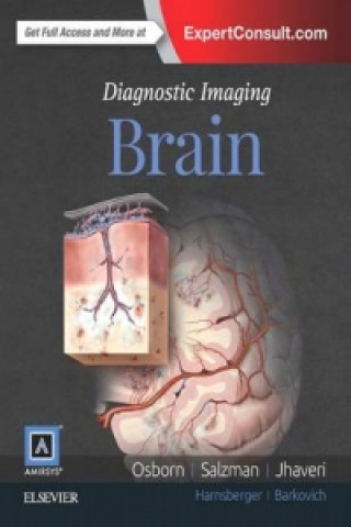Carte Diagnostic Imaging: Brain A.G. OSBORN