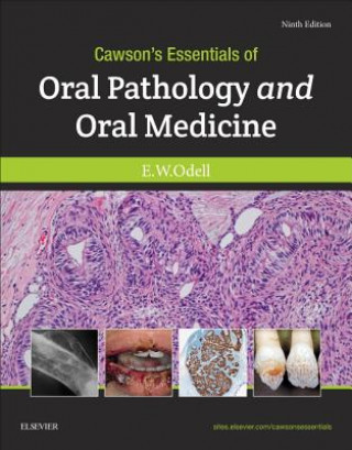 Könyv Cawson's Essentials of Oral Pathology and Oral Medicine EDWARD W. ODELL